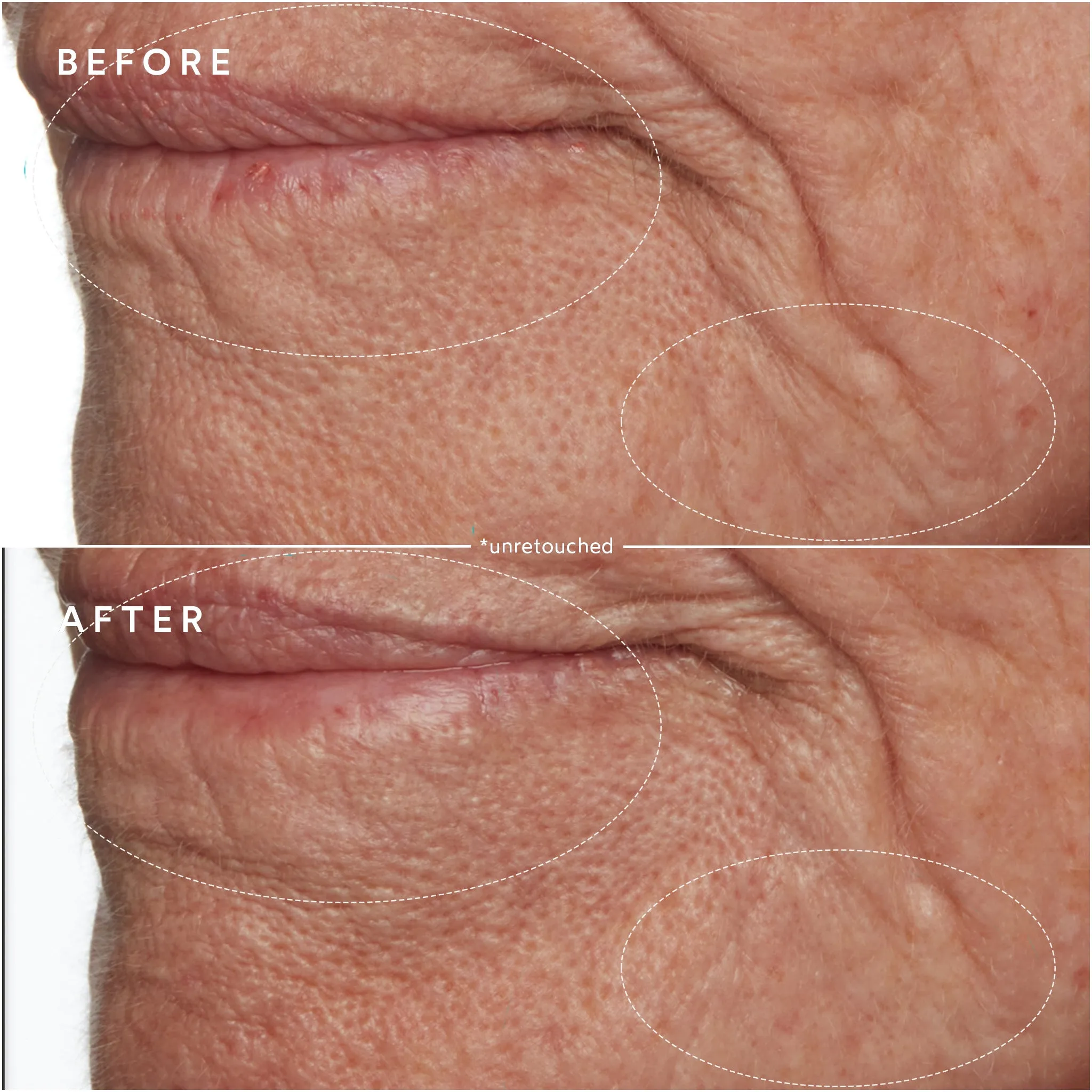 Moisture Lock Overnight Mask