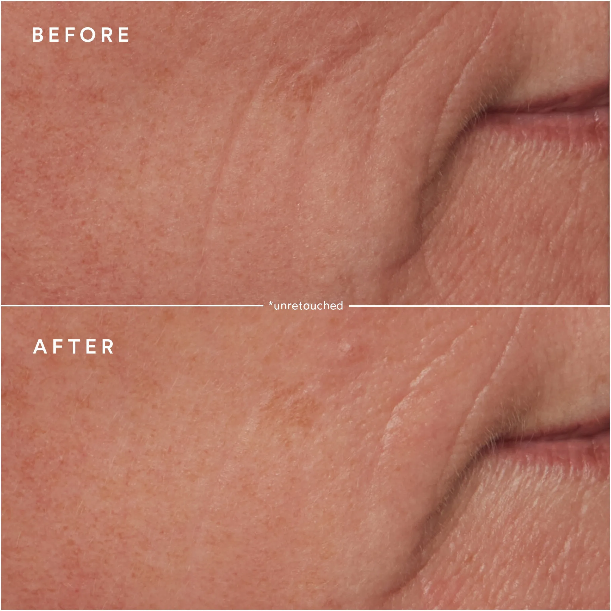 Moisture Lock Overnight Mask